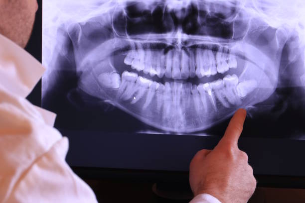 Best Emergency Gum Pain Relief  in El Paso, IL