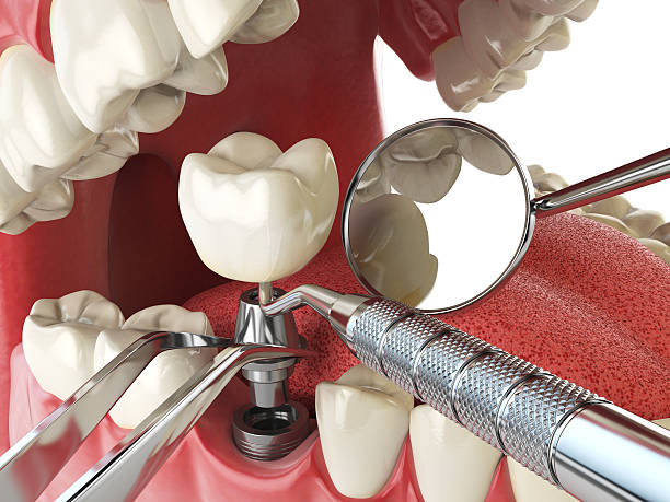 Best Emergency Tooth Extraction  in El Paso, IL